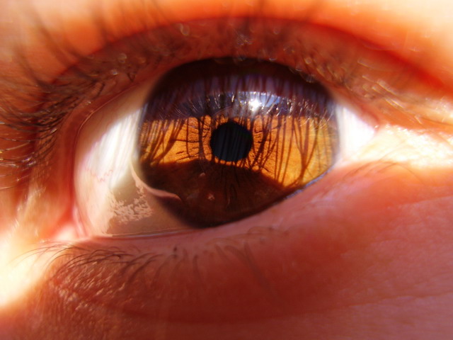 Hazel eye