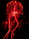 MEDUZA